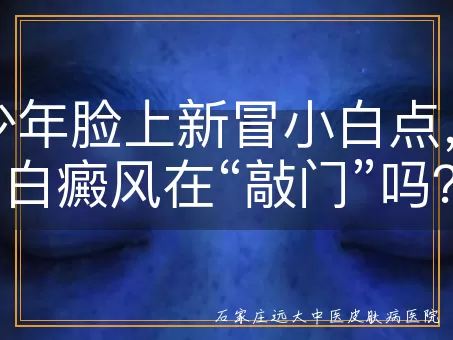 青少年脸上新冒小白点，是白癜风在“敲门”吗？