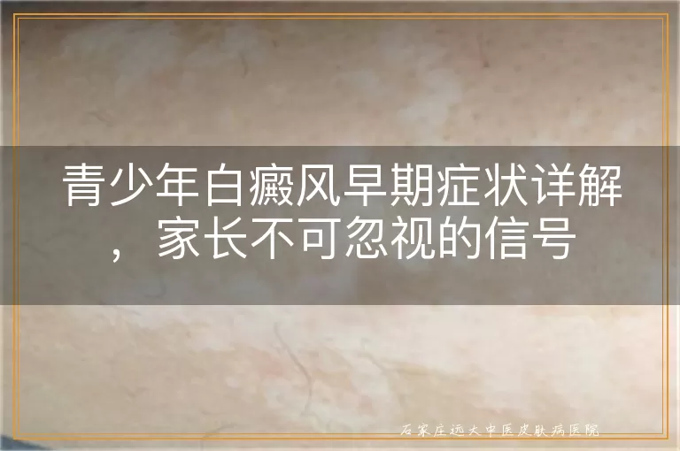 青少年白癜风早期症状详解，家长不可忽视的信号