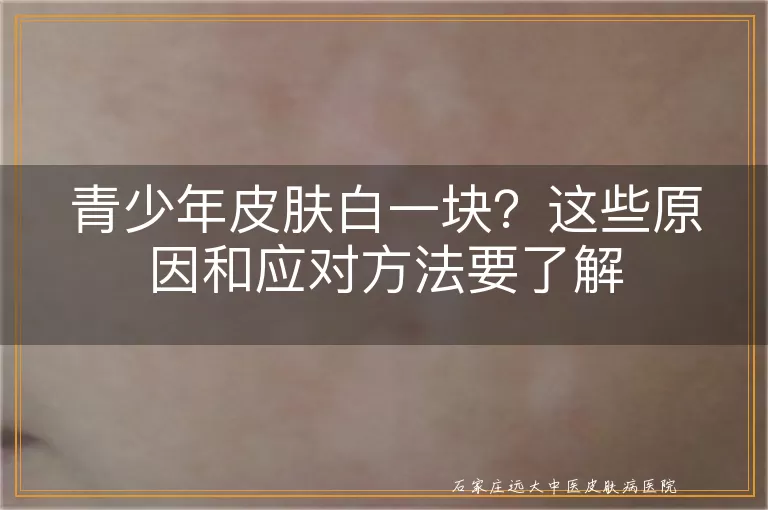 青少年皮肤白一块？这些原因和应对方法要了解