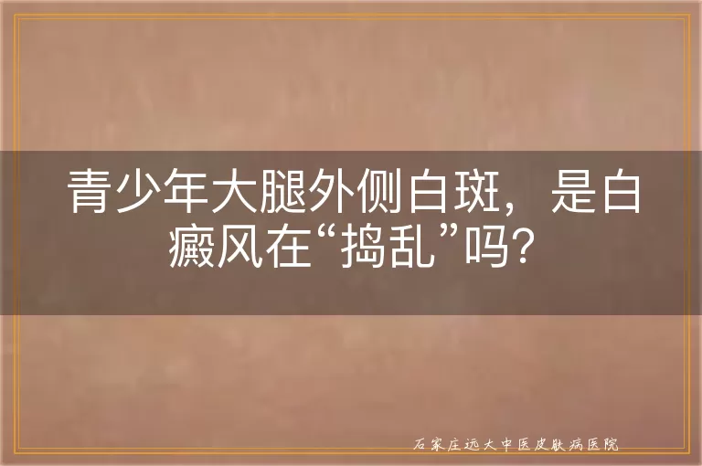 青少年大腿外侧白斑，是白癜风在“捣乱”吗？