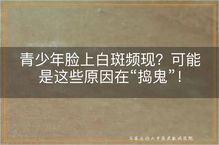 青少年脸上白斑频现？可能是这些原因在“捣鬼”！