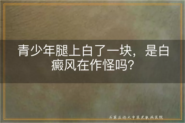青少年腿上白了一块，是白癜风在作怪吗？