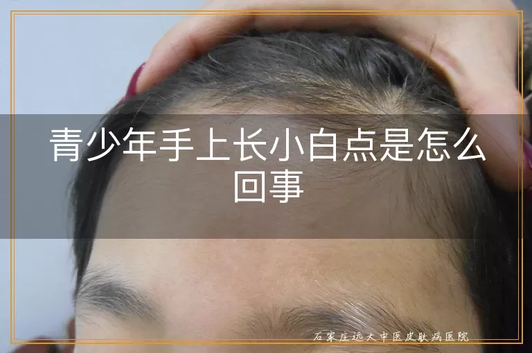 青少年手上长小白点是怎么回事