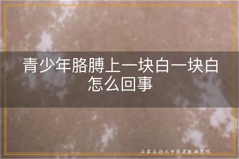 青少年胳膊上一块白一块白怎么回事