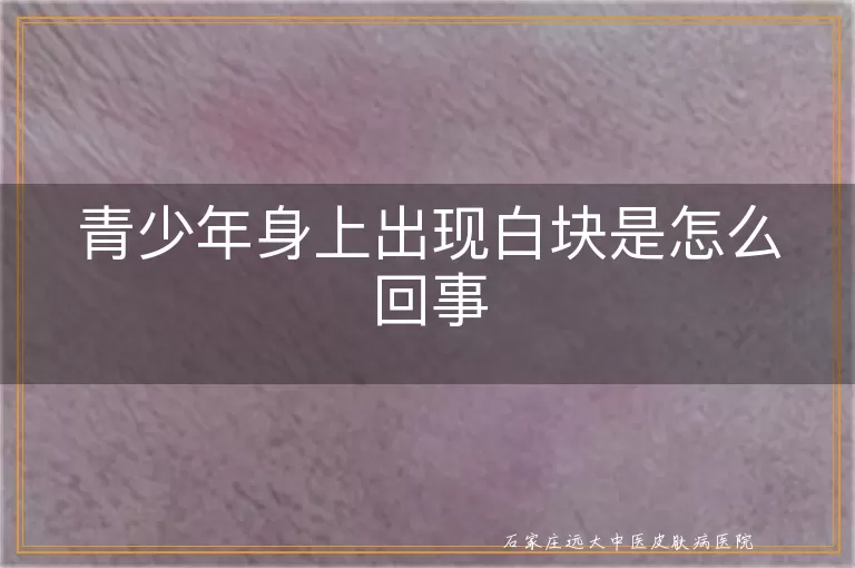 青少年身上出现白块是怎么回事