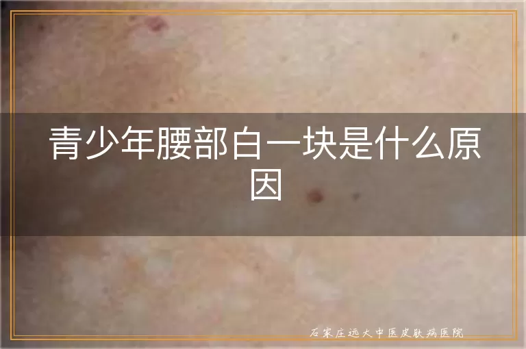 青少年腰部白一块是什么原因