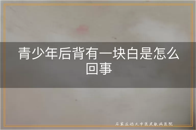 青少年后背有一块白是怎么回事