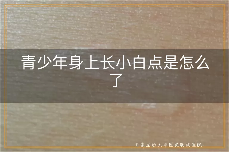 青少年身上长小白点是怎么了
