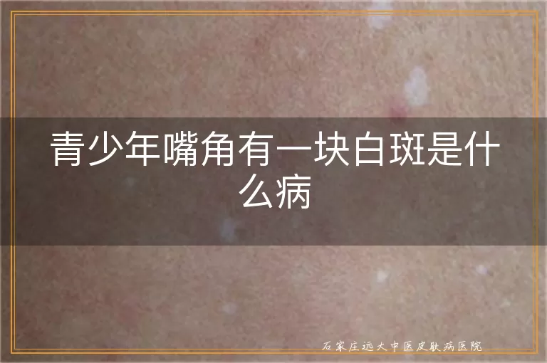 青少年嘴角有一块白斑是什么病