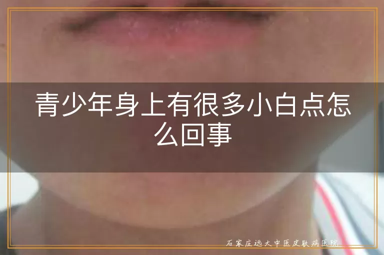 青少年身上有很多小白点怎么回事