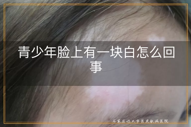 青少年脸上有一块白怎么回事
