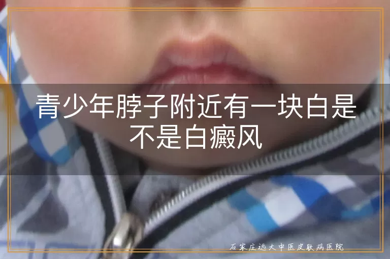 青少年脖子附近有一块白是不是白癜风