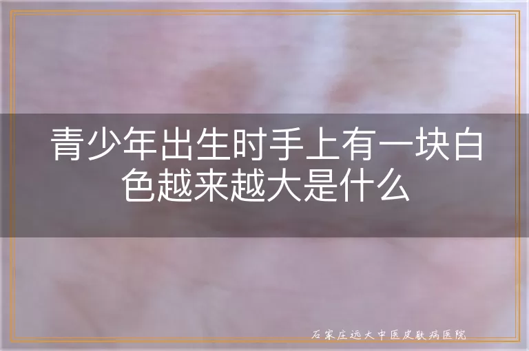 青少年出生时手上有一块白色越来越大是什么
