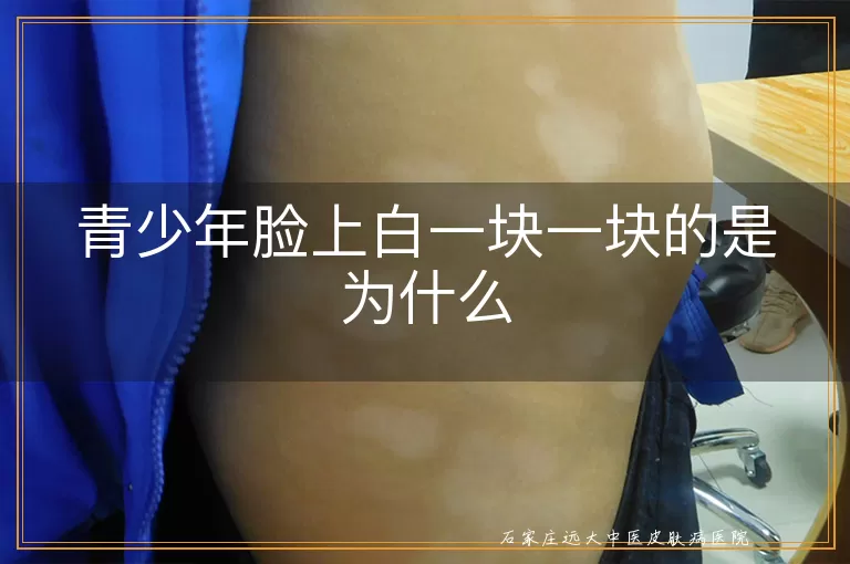 青少年脸上白一块一块的是为什么