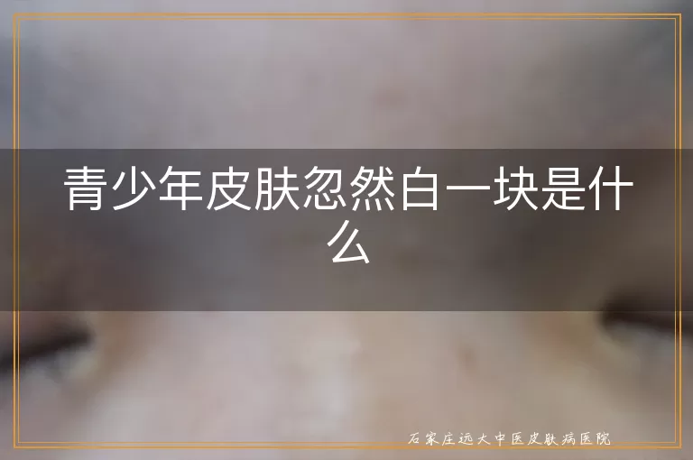青少年皮肤忽然白一块是什么