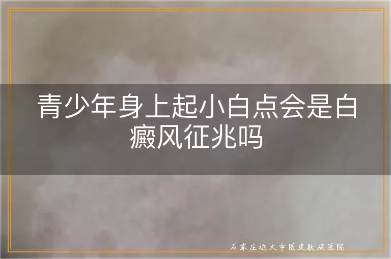青少年身上起小白点会是白癜风征兆吗