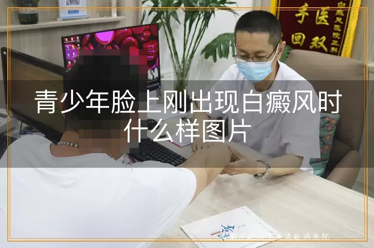 青少年脸上刚出现白癜风时什么样图片