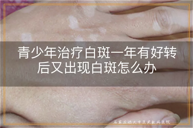 青少年治疗白斑一年有好转后又出现白斑怎么办