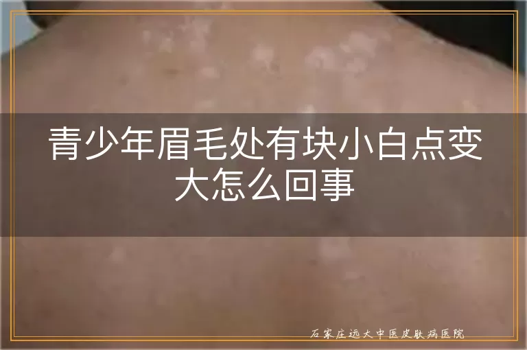 青少年眉毛处有块小白点变大怎么回事