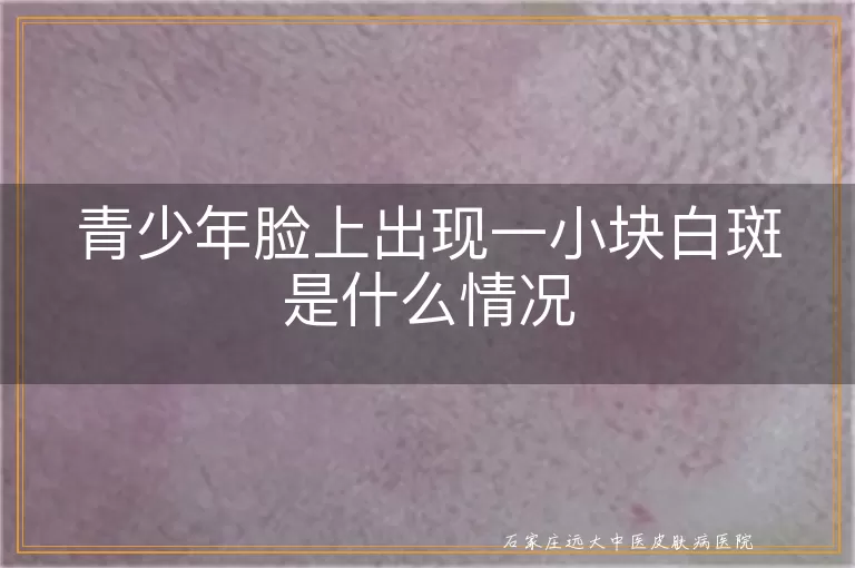 青少年脸上出现一小块白斑是什么情况