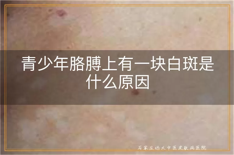 青少年胳膊上有一块白斑是什么原因