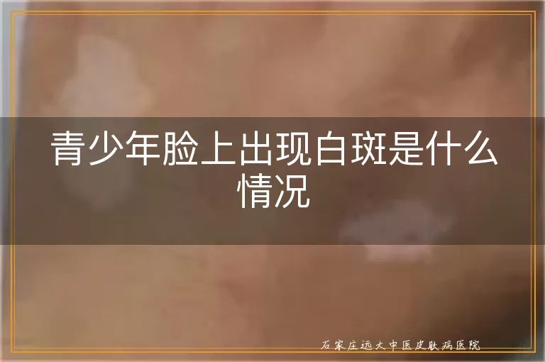 青少年脸上出现白斑是什么情况