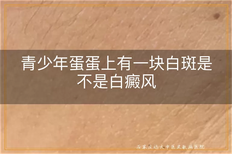 青少年蛋蛋上有一块白斑是不是白癜风