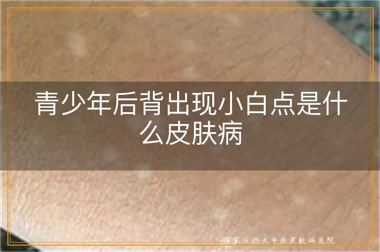 青少年后背出现小白点是什么皮肤病