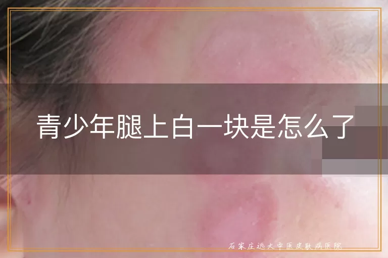 青少年腿上白一块是怎么了