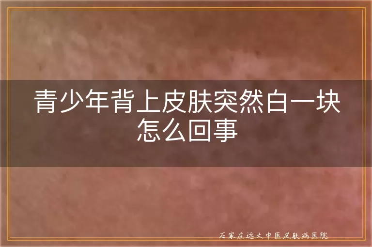 青少年背上皮肤突然白一块怎么回事