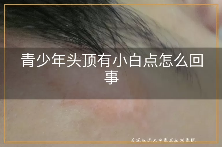 青少年头顶有小白点怎么回事