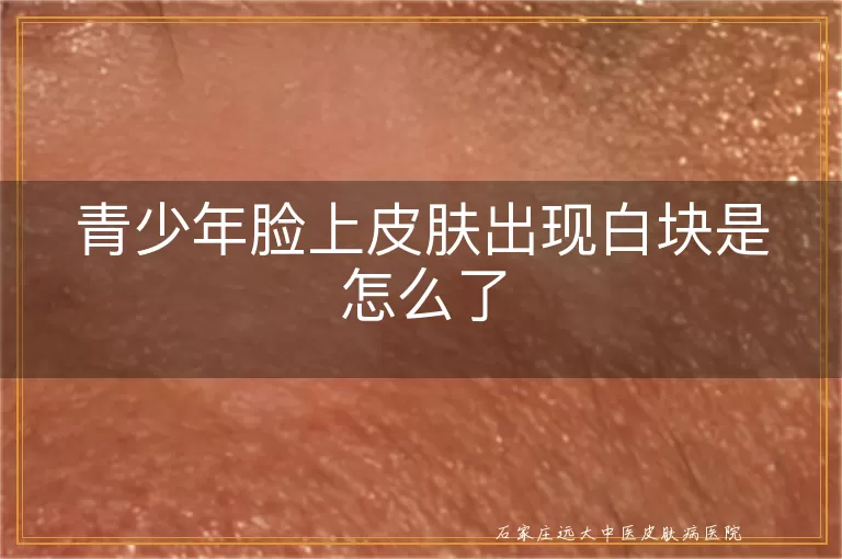青少年脸上皮肤出现白块是怎么了