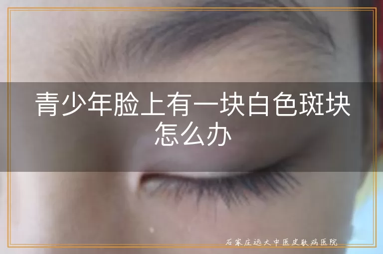 青少年脸上有一块白色斑块怎么办