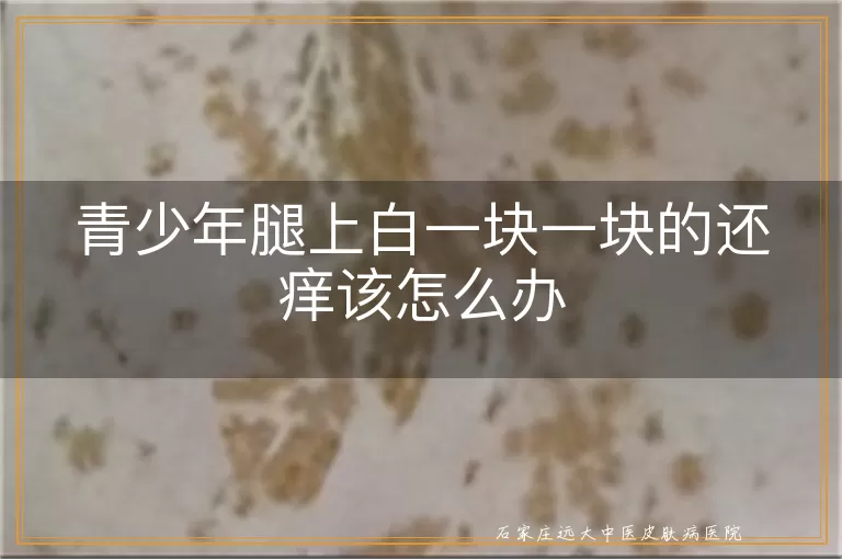 青少年腿上白一块一块的还痒该怎么办