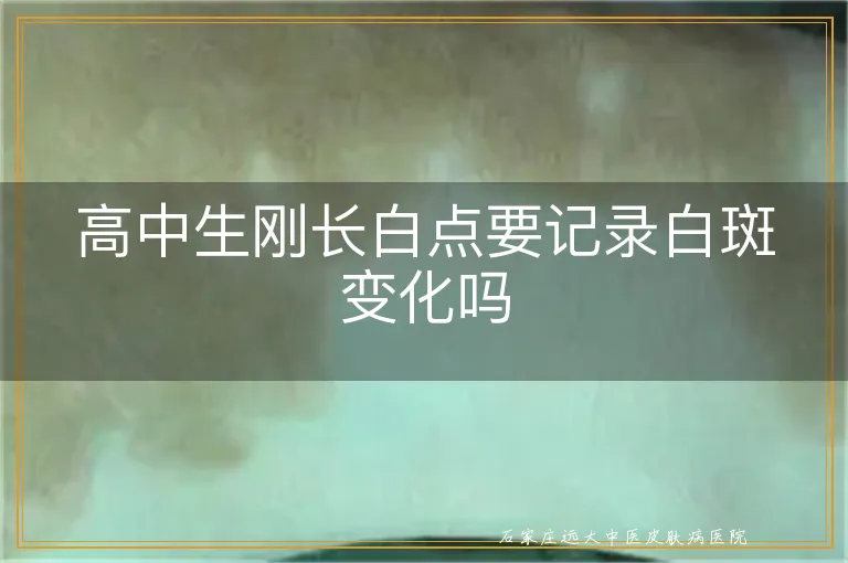 高中生刚长白点要记录白斑变化吗