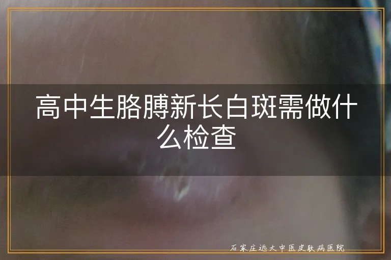 高中生胳膊新长白斑需做什么检查