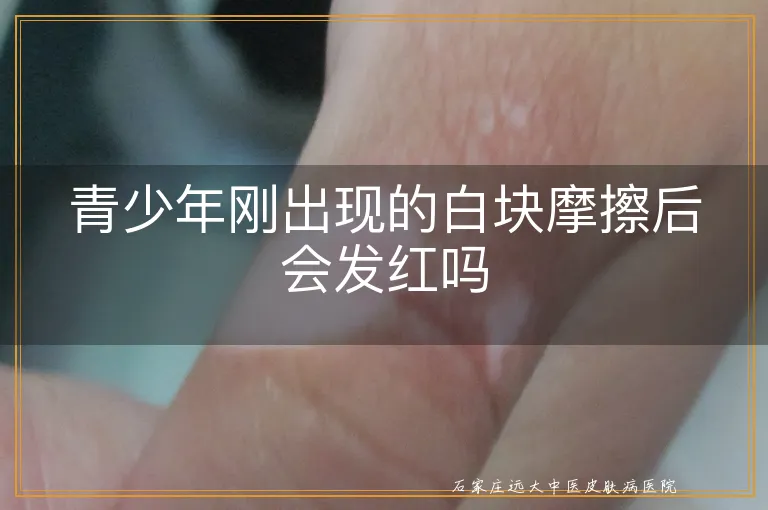 青少年刚出现的白块摩擦后会发红吗