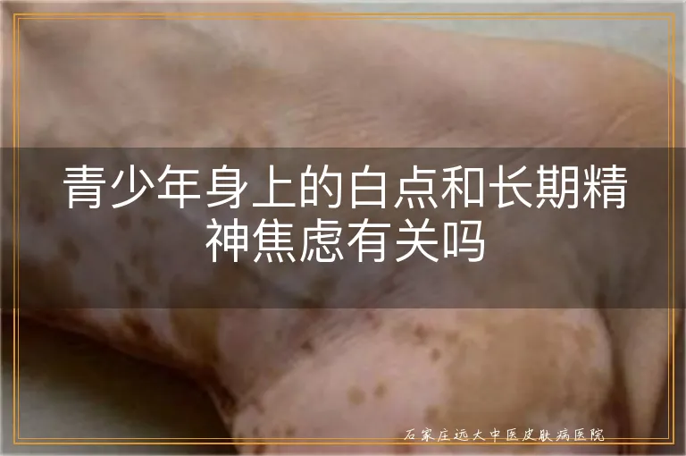 青少年身上的白点和长期精神焦虑有关吗