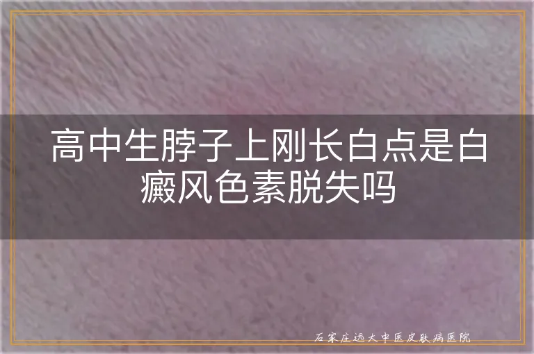 高中生脖子上刚长白点是白癜风色素脱失吗