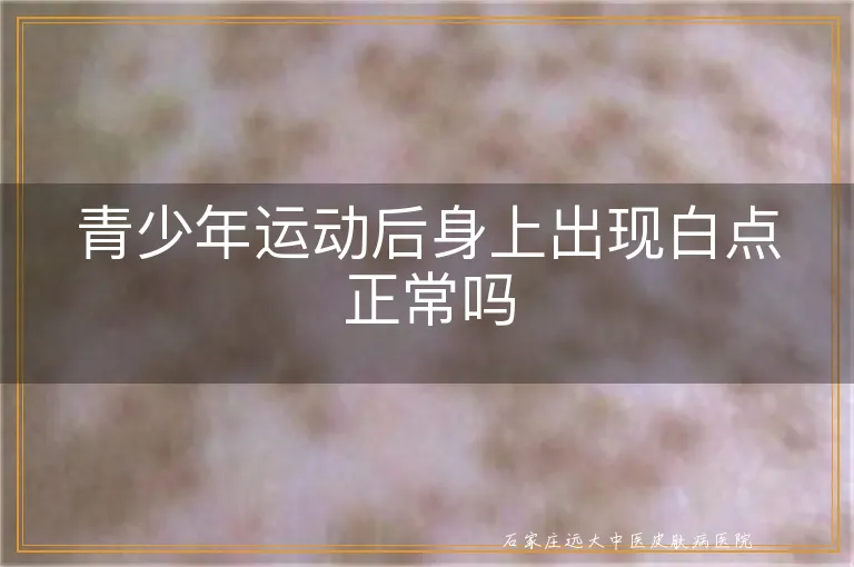 青少年运动后身上出现白点正常吗