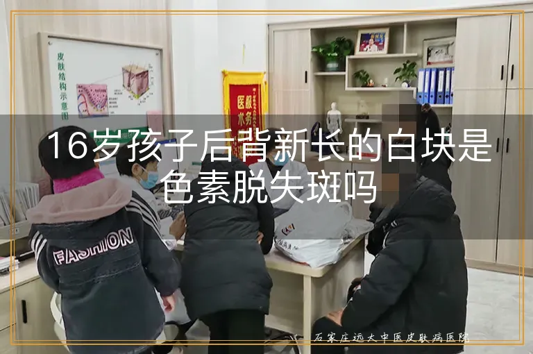 16岁孩子后背新长的白块是色素脱失斑吗