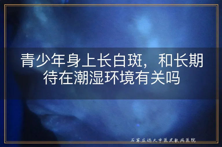 青少年身上长白斑,和长期待在潮湿环境有关吗