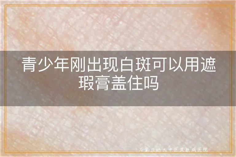 青少年刚出现白斑可以用遮瑕膏盖住吗