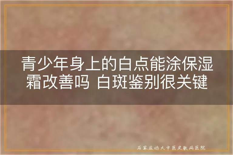 青少年身上的白点能涂保湿霜改善吗 白斑鉴别很关键
