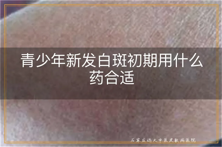 青少年新发白斑初期用什么药合适