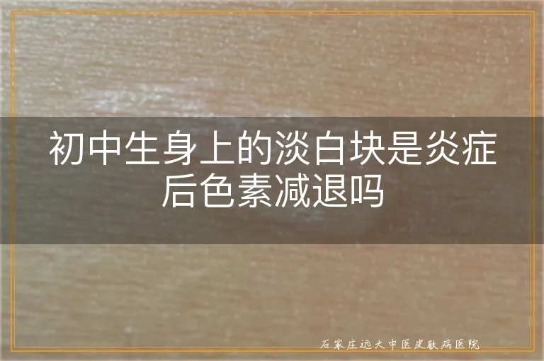 初中生身上的淡白块是炎症后色素减退吗