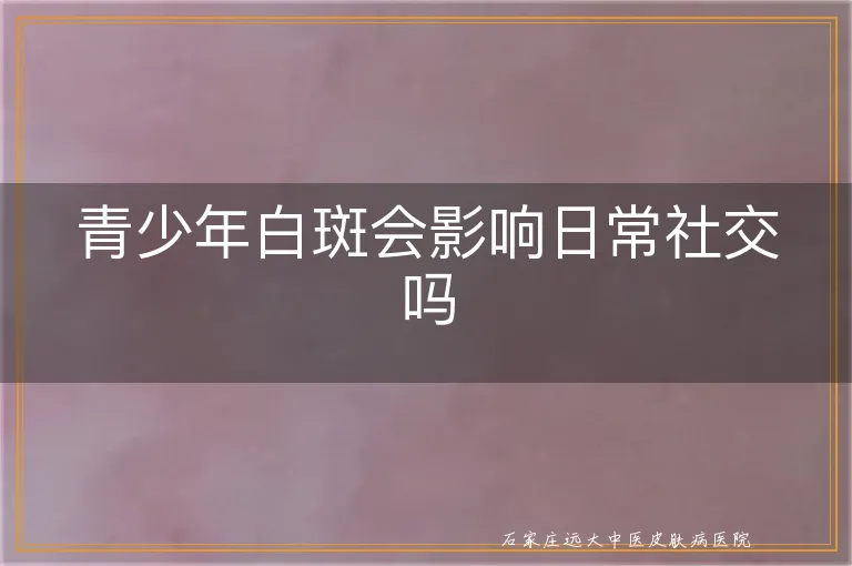 青少年白斑会影响日常社交吗