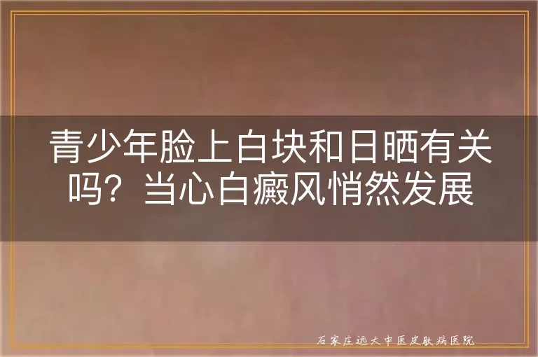 青少年脸上白块和日晒有关吗？当心白癜风悄然发展