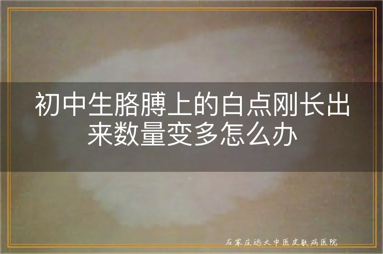 初中生胳膊上的白点刚长出来数量变多怎么办