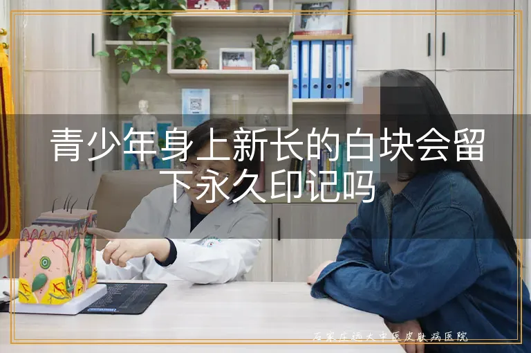 青少年身上新长的白块会留下永久印记吗